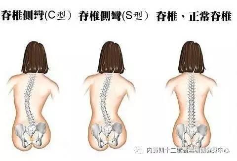 脊椎弯曲矫正视频成人